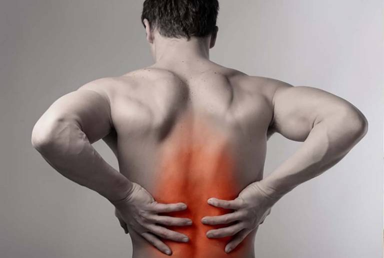 Căng cơ vùng lưng là tình trạng các cơ ở lưng bị căng quá mức và tạo ra các vết rách bên trong.
