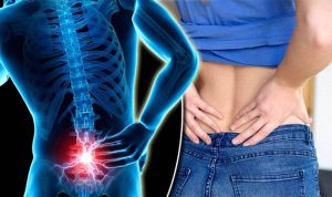Thoái hóa khớp là một trong những nguyên nhân chính gây ra tình trạng đau lưng xuống xương chậu