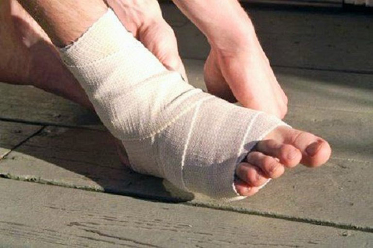 Chấn thương được coi là một trong những nguyên nhân phổ biến nhất gây đau mu bàn chân