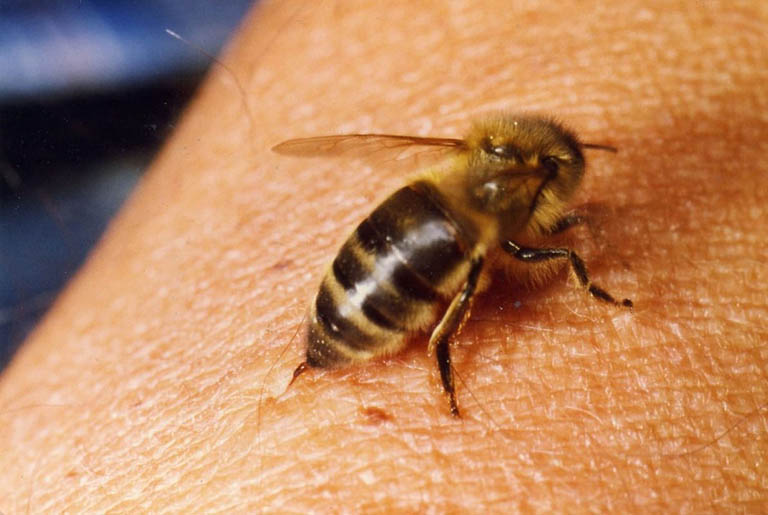 Nọc ong có khả năng giảm đau nhức xương khớp, trị hen suyễn, phục hồi hệ thần kinh ngoại biên