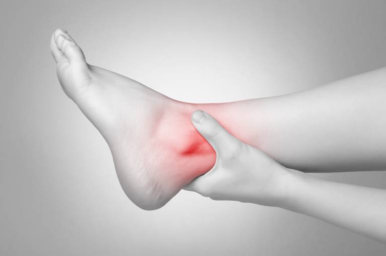 Viêm khớp cổ chân là bệnh xương khớp gây ảnh hưởng đến chức năng của chân